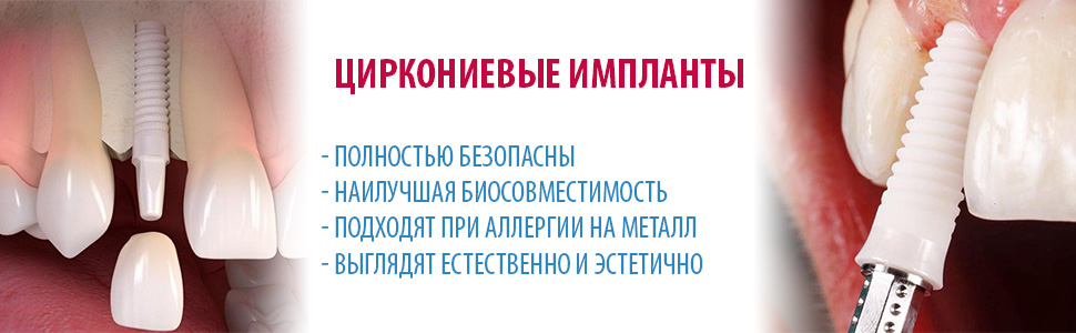 Циркониевые импланты
